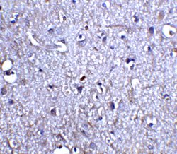 Invitrogen Neurturin Polyclonal Antibody 100 &mu;g; Unconjugated:Antibodies,