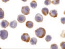 Invitrogen ADAM17 Polyclonal Antibody 100 &mu;g; Unconjugated:Antibodies,