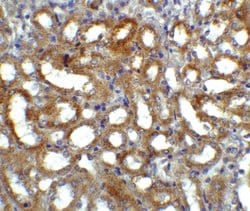 Invitrogen GFR alpha-3 Polyclonal Antibody 100 &mu;g; Unconjugated:Antibodies,