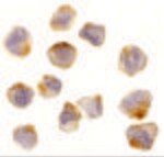 Thumbnail_ASK1 Polyclonal Antibody, Invitrogen 100 &mu;g; Unconjugated:Antibodies,