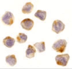 ASK1 Polyclonal Antibody, Invitrogen 100 &mu;g; Unconjugated:Antibodies,