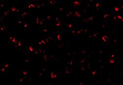ASK1 Polyclonal Antibody, Invitrogen 100 &mu;g; Unconjugated:Antibodies,