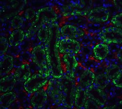 Invitrogen DFFB Polyclonal Antibody 100 &mu;g | Buy Online | Invitrogen&trade; | Fisher Scientific