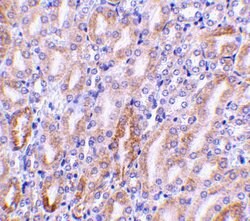 Invitrogen DFFB Polyclonal Antibody 100 &mu;g | Buy Online | Invitrogen&trade; | Fisher Scientific