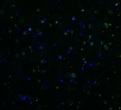 Invitrogen TRAIL-R2 (DR5) Polyclonal Antibody 100 &mu;g; Unconjugated:Antibodies,