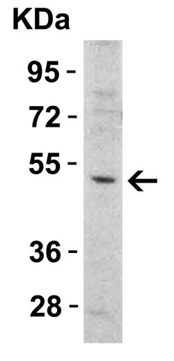 Invitrogen TRAIL-R2 (DR5) Polyclonal Antibody 100 &mu;g; Unconjugated:Antibodies,