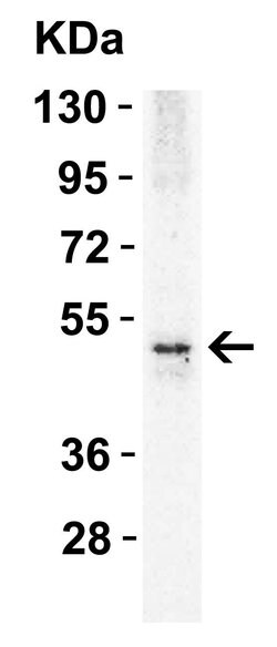 Invitrogen TRAIL-R2 (DR5) Polyclonal Antibody 100 &mu;g; Unconjugated:Antibodies,