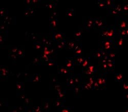 Invitrogen IKK alpha Polyclonal Antibody 100 &mu;g | Buy Online | Invitrogen&trade; | Fisher Scientific