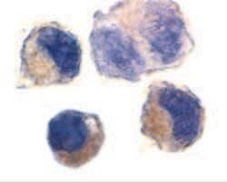 Invitrogen ADAM10 Polyclonal Antibody 100 &mu;g; Unconjugated:Antibodies,