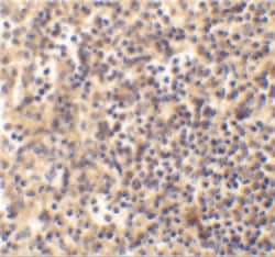 Invitrogen DNase II Polyclonal Antibody 100 &mu;g; Unconjugated:Antibodies,