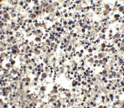 Invitrogen CIDEA Polyclonal Antibody 100 &mu;g; Unconjugated:Antibodies,