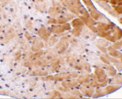 Invitrogen CIDEA Polyclonal Antibody 100 &mu;g; Unconjugated:Antibodies,