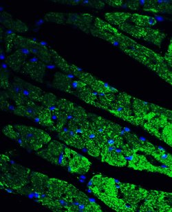 Invitrogen CX3CR1 Polyclonal Antibody 100 &mu;g; Unconjugated:Antibodies,