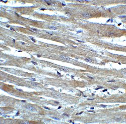 Invitrogen CX3CR1 Polyclonal Antibody 100 &mu;g; Unconjugated:Antibodies,