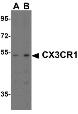 Invitrogen CX3CR1 Polyclonal Antibody 100 &mu;g; Unconjugated:Antibodies,