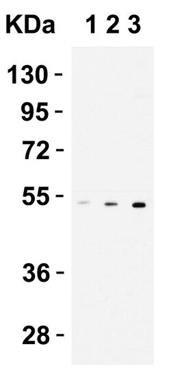 Invitrogen CX3CR1 Polyclonal Antibody 100 &mu;g; Unconjugated:Antibodies,