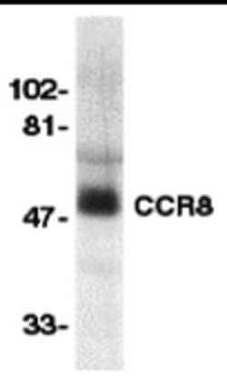 Invitrogen CCR8 Polyclonal Antibody 100 &mu;g; Unconjugated:Antibodies,