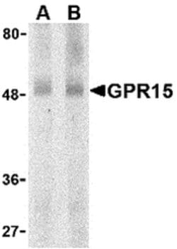 Invitrogen GPR15 Polyclonal Antibody 100 &mu;g; Unconjugated:Antibodies,