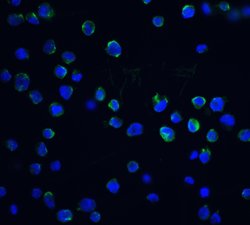 Invitrogen DFFB Polyclonal Antibody 100 &mu;g; Unconjugated:Antibodies,