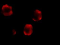 Invitrogen IRAK2 Polyclonal Antibody 100 &mu;g | Buy Online | Invitrogen&trade; | Fisher Scientific