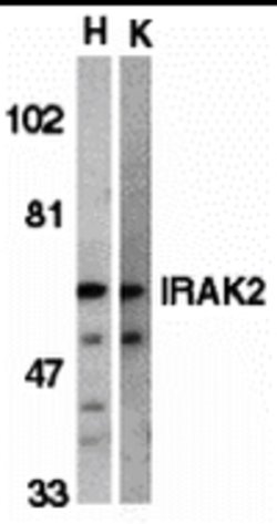 Invitrogen IRAK2 Polyclonal Antibody 100 &mu;g | Buy Online | Invitrogen&trade; | Fisher Scientific