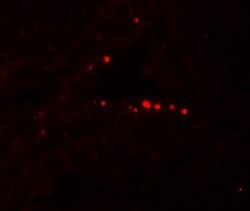 Invitrogen MyD88 Polyclonal Antibody 100 &mu;g | Buy Online | Invitrogen&trade; | Fisher Scientific