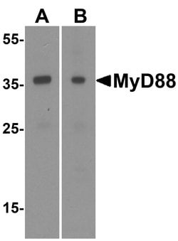 Invitrogen MyD88 Polyclonal Antibody 100 &mu;g | Buy Online | Invitrogen&trade; | Fisher Scientific