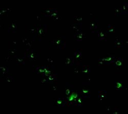 Invitrogen DFFB Polyclonal Antibody 100 &mu;g; Unconjugated:Antibodies,