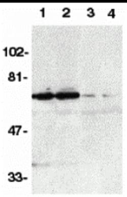 Invitrogen DR6 Polyclonal Antibody 100 &mu;g; Unconjugated:Antibodies,