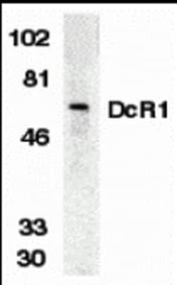 Invitrogen CD263 (TRAIL-R3) Polyclonal Antibody 100 &mu;g; Unconjugated:Antibodies,