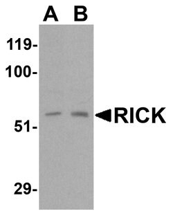 Invitrogen RIP2 Polyclonal Antibody 100 &mu;g; Unconjugated:Antibodies,