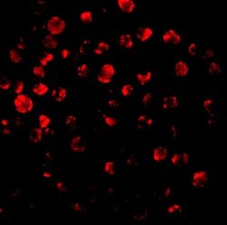 Invitrogen IRAK2 Polyclonal Antibody 100 &mu;g; Unconjugated:Antibodies,