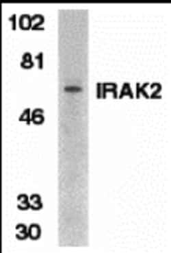 Invitrogen IRAK2 Polyclonal Antibody 100 &mu;g; Unconjugated:Antibodies,