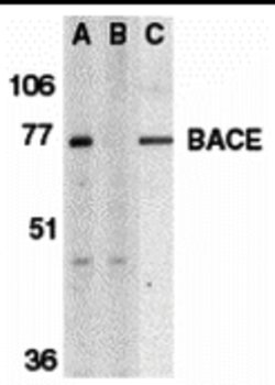 Invitrogen BACE1 Polyclonal Antibody 100 &mu;g; Unconjugated:Antibodies,