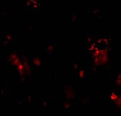 Invitrogen CD263 (TRAIL-R3) Polyclonal Antibody 100 &mu;g; Unconjugated:Antibodies,