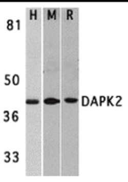 Invitrogen DAPK2 Polyclonal Antibody 100 &mu;g | Buy Online | Invitrogen&trade; | Fisher Scientific