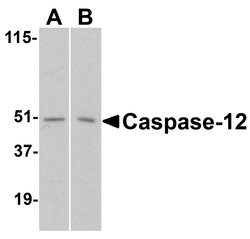 Invitrogen Caspase 12 Polyclonal Antibody 100 &mu;g | Buy Online | Invitrogen&trade; | Fisher Scientific