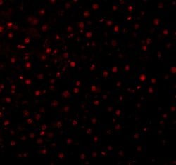 Invitrogen Caspase 12 Polyclonal Antibody 100 &mu;g | Buy Online | Invitrogen&trade; | Fisher Scientific