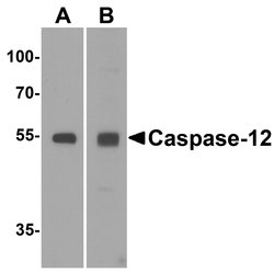 Invitrogen Caspase 12 Polyclonal Antibody 100 &mu;g | Buy Online | Invitrogen&trade; | Fisher Scientific