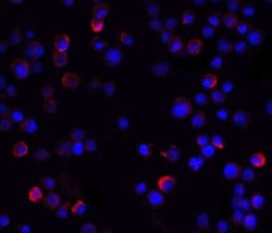 Invitrogen IKK gamma Polyclonal Antibody 100 &mu;g | Buy Online | Invitrogen&trade; | Fisher Scientific