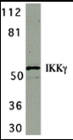 Invitrogen IKK gamma Polyclonal Antibody 100 &mu;g | Buy Online | Invitrogen&trade; | Fisher Scientific