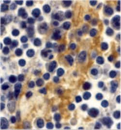 Invitrogen DC-SIGN Polyclonal Antibody 100 &mu;g; Unconjugated:Antibodies,