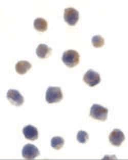 Invitrogen CHK2 Polyclonal Antibody 100 &mu;g; Unconjugated:Antibodies,