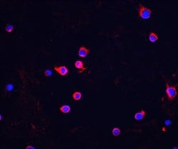 Invitrogen CHK2 Polyclonal Antibody 100 &mu;g; Unconjugated:Antibodies,