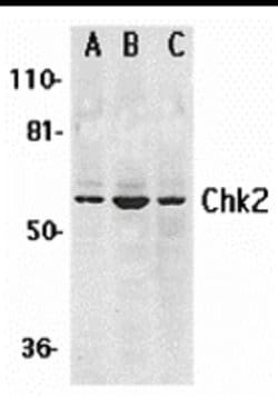 Invitrogen CHK2 Polyclonal Antibody 100 &mu;g; Unconjugated:Antibodies,