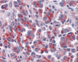 DIABLO Polyclonal Antibody:Antibodies, Polyclonal