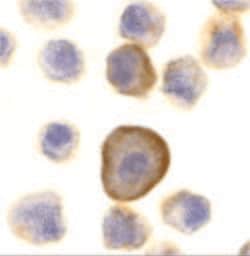 Invitrogen PERP Polyclonal Antibody 100 &mu;g; Unconjugated:Antibodies,