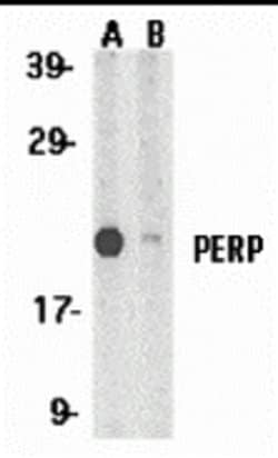 Invitrogen PERP Polyclonal Antibody 100 &mu;g; Unconjugated:Antibodies,
