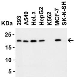 Invitrogen PERP Polyclonal Antibody 100 &mu;g; Unconjugated:Antibodies,