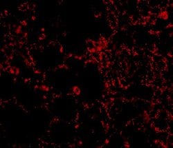 Invitrogen IL21R Polyclonal Antibody 100 &mu;g; Unconjugated:Antibodies,